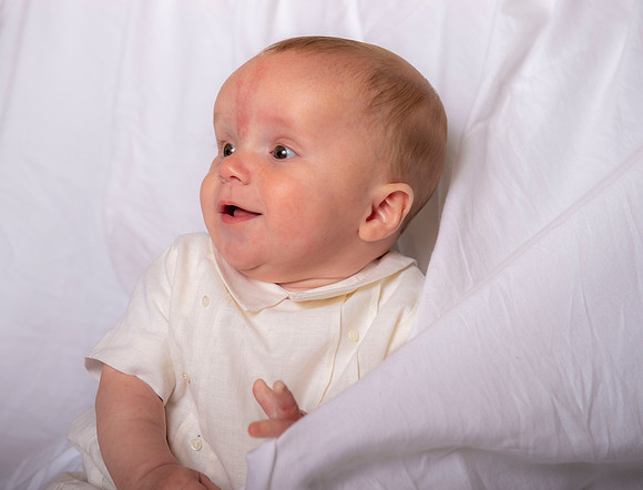 Conrad 6 months 151