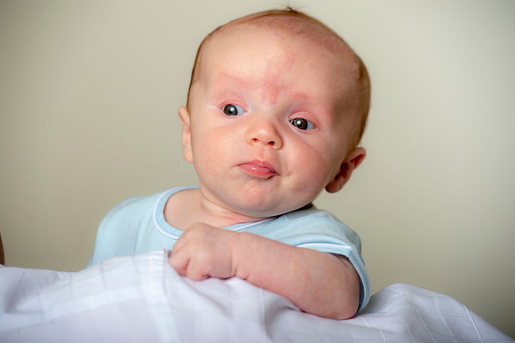 Conrad 3 months 166